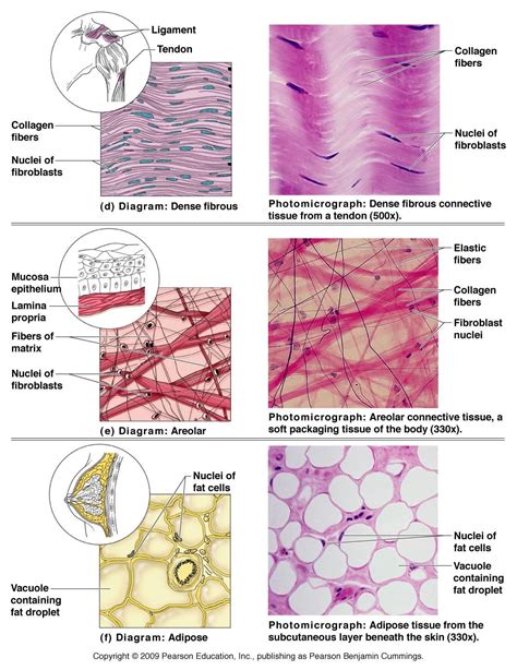 All Of The Following Are Dense Connective Tissues Except