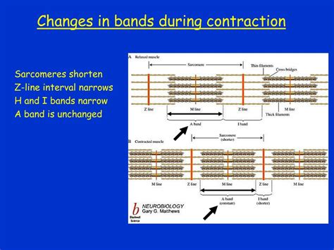 Does The I Band Shorten During Contraction