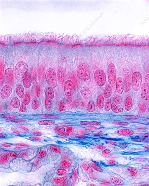 Pseudostratified Ciliated Columnar Epithelium Is Found Lining