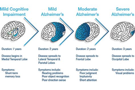 Which Of The Following Statements Is True About Alzheimer's Disease