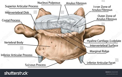 Which Type Of Cartilage Is Found In The Intervertebral Discs